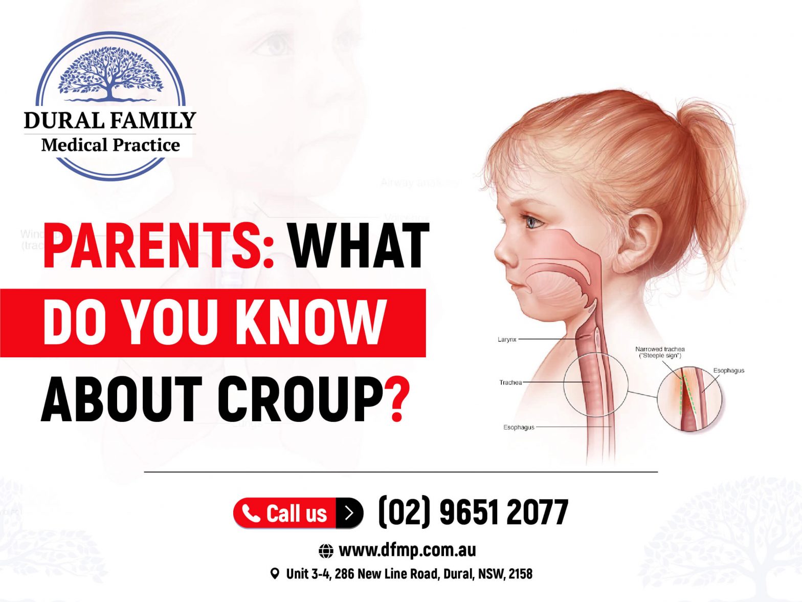 What do you know about Croup?
